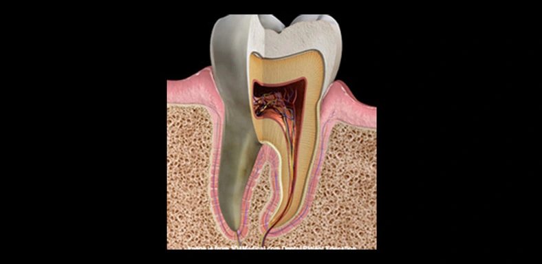 gum-disease