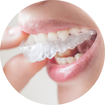 Invisalign